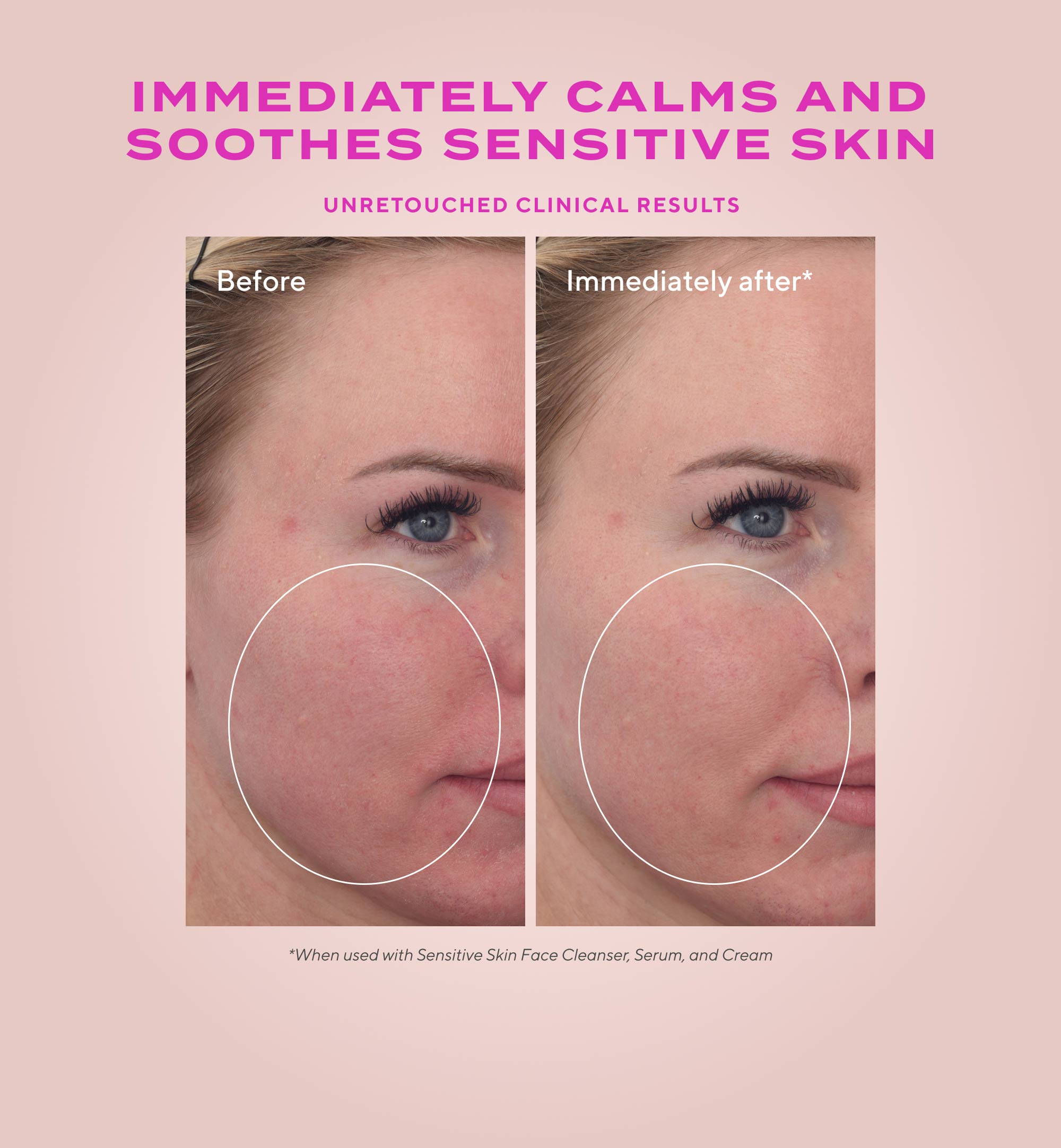Heartleaf Calming Cream Moisturizer for Sensitive Skin and Eczema-Prone Skin - Image 3