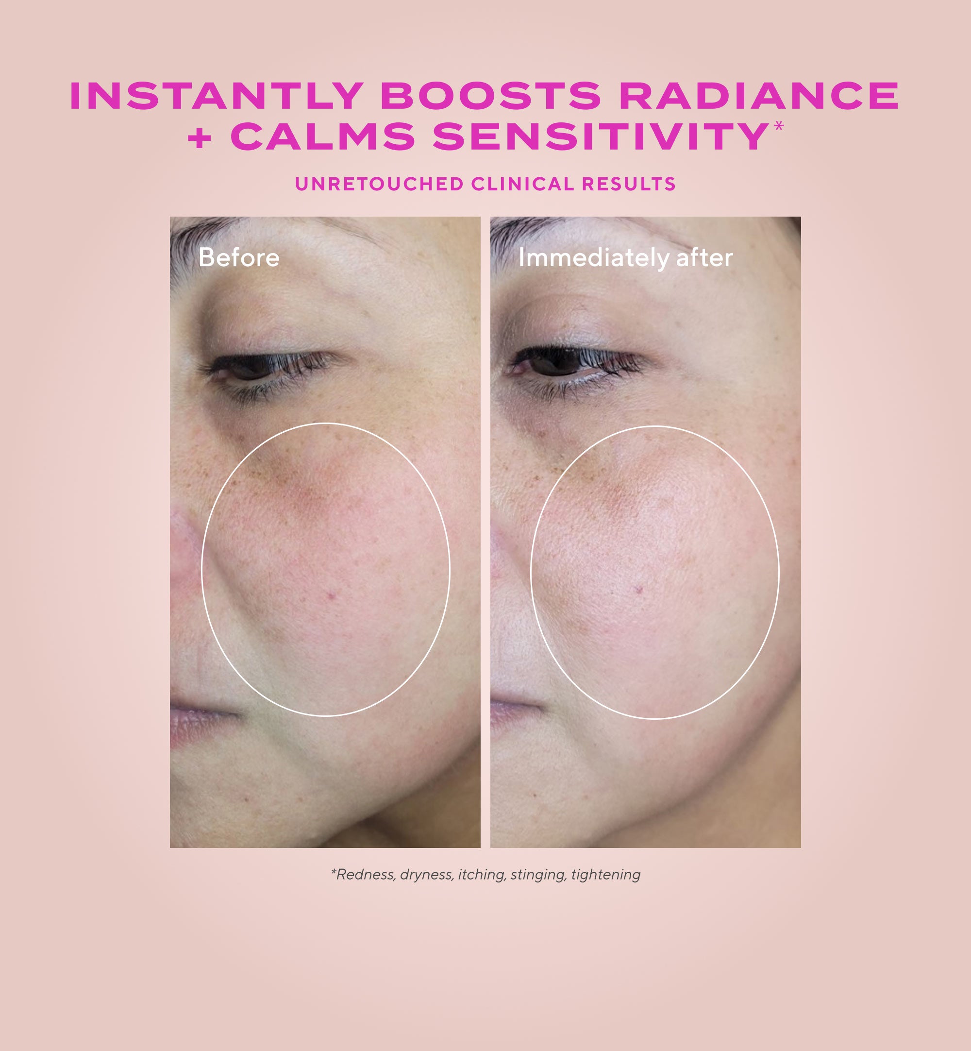 Gentle Glycolic Acid Resurfacing Serum for Sensitive Skin Refill - Image 3