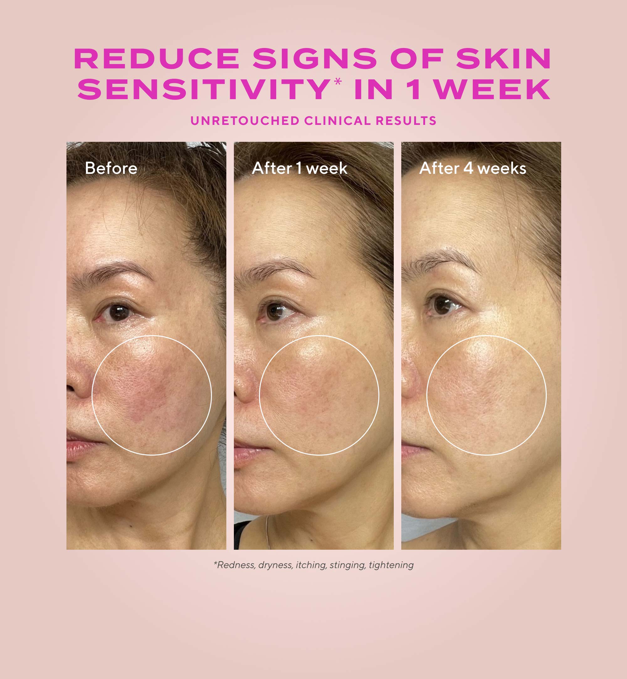 Gentle Glycolic Acid Resurfacing Serum for Sensitive Skin - Image 4