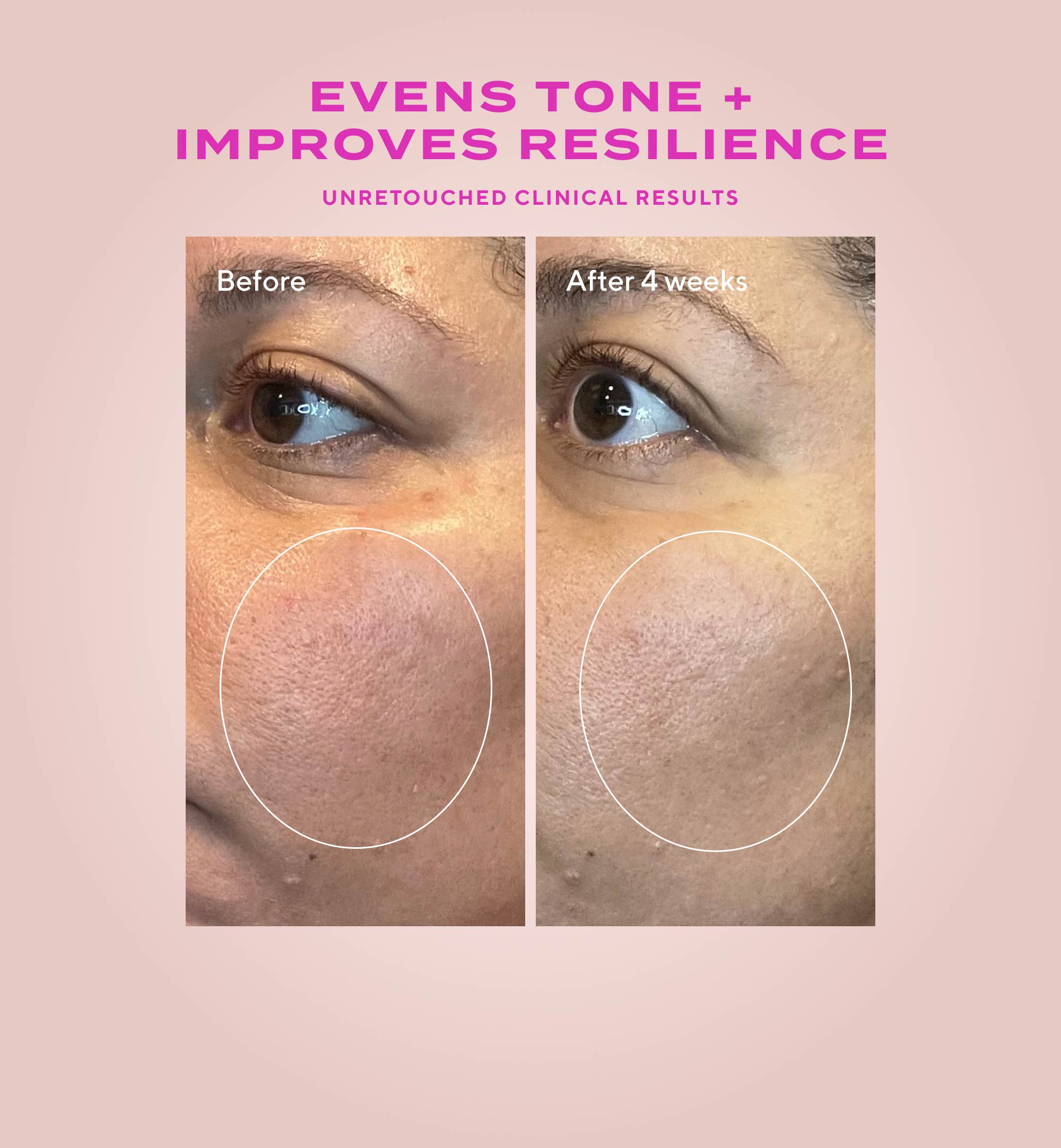 Gentle Glycolic Acid Resurfacing Serum for Sensitive Skin Refill - Image 5