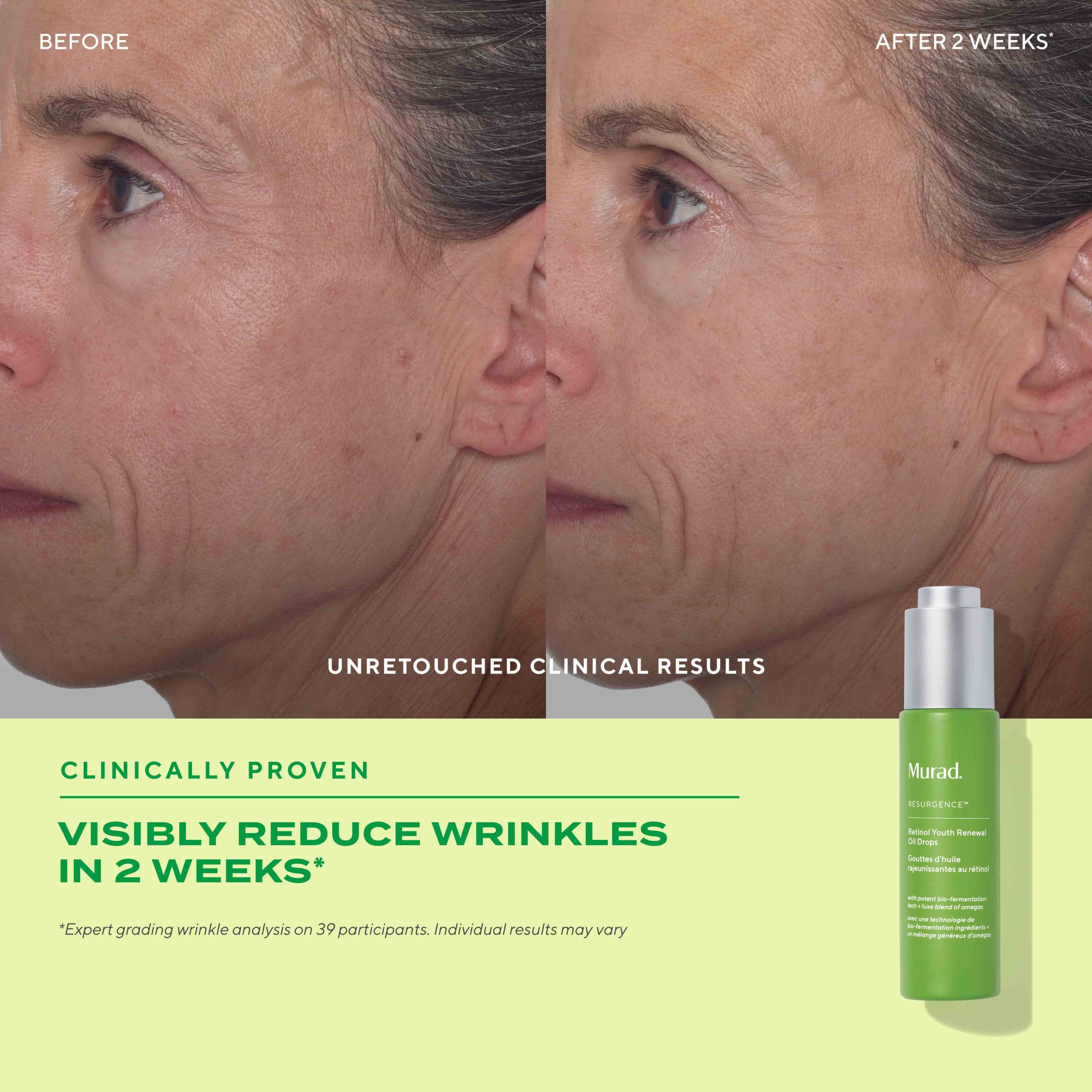 Retinol Youth Renewal Face Oil Drops - Image 4