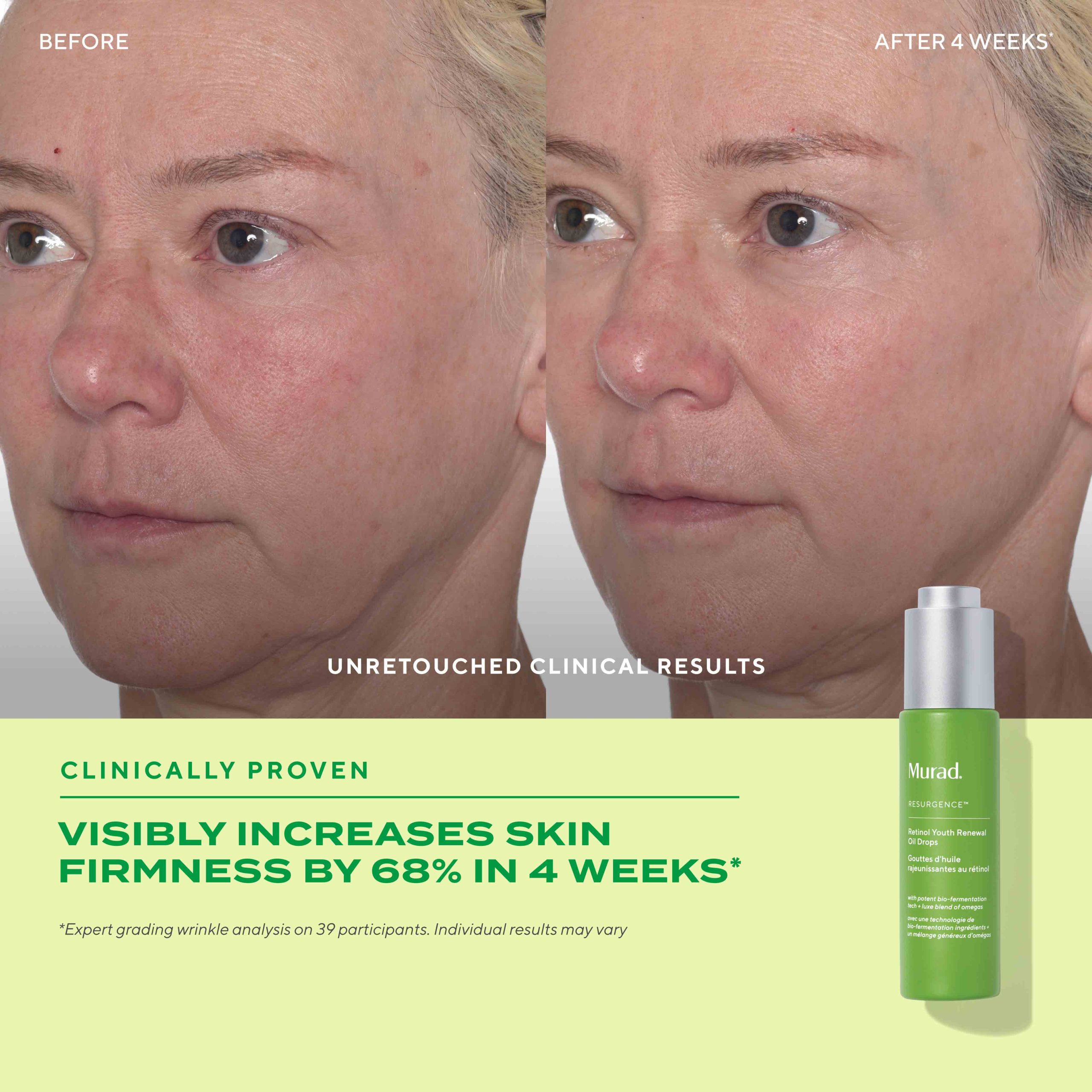 Retinol Youth Renewal Face Oil Drops - Image 8