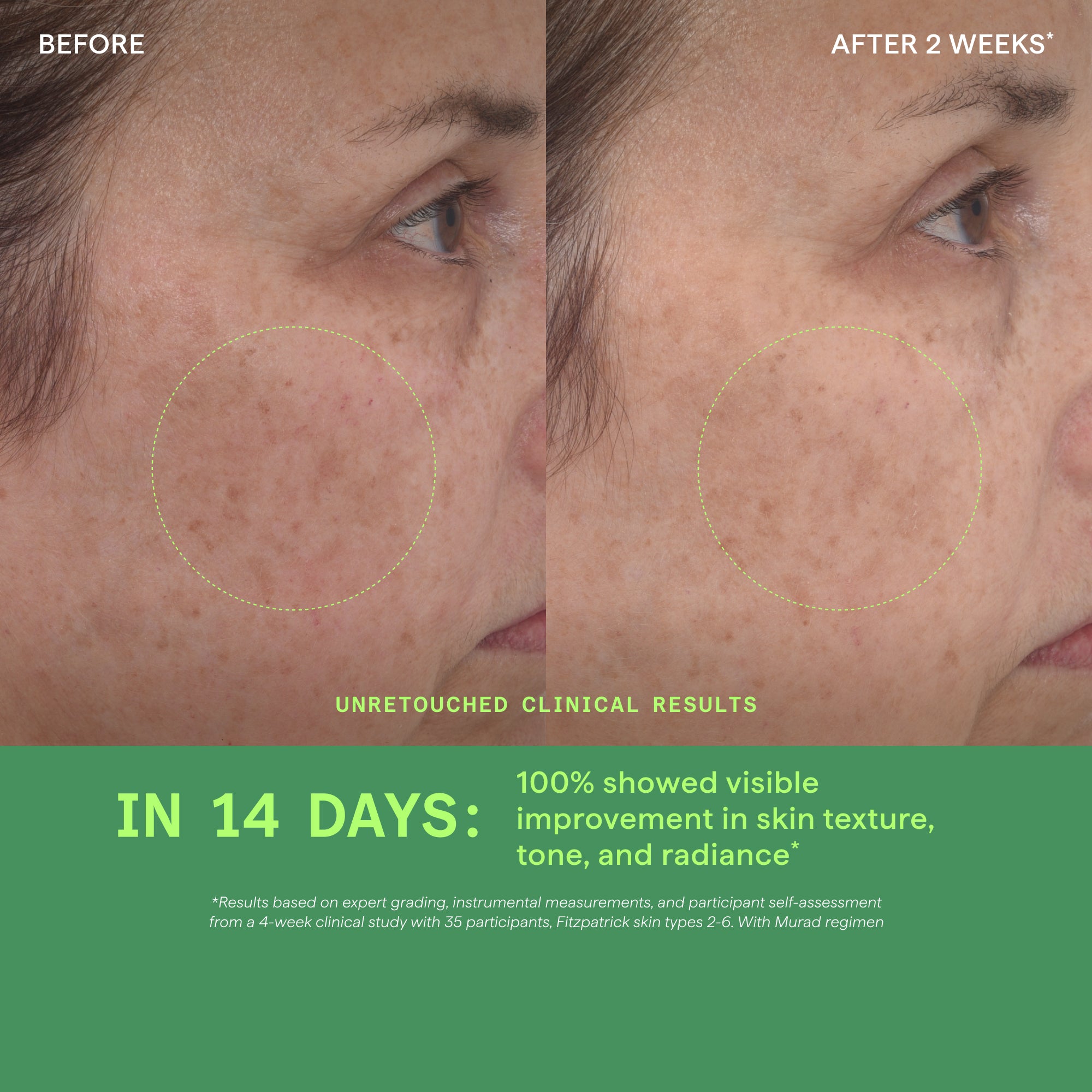 Retinol Youth Renewal Serum - Image 5